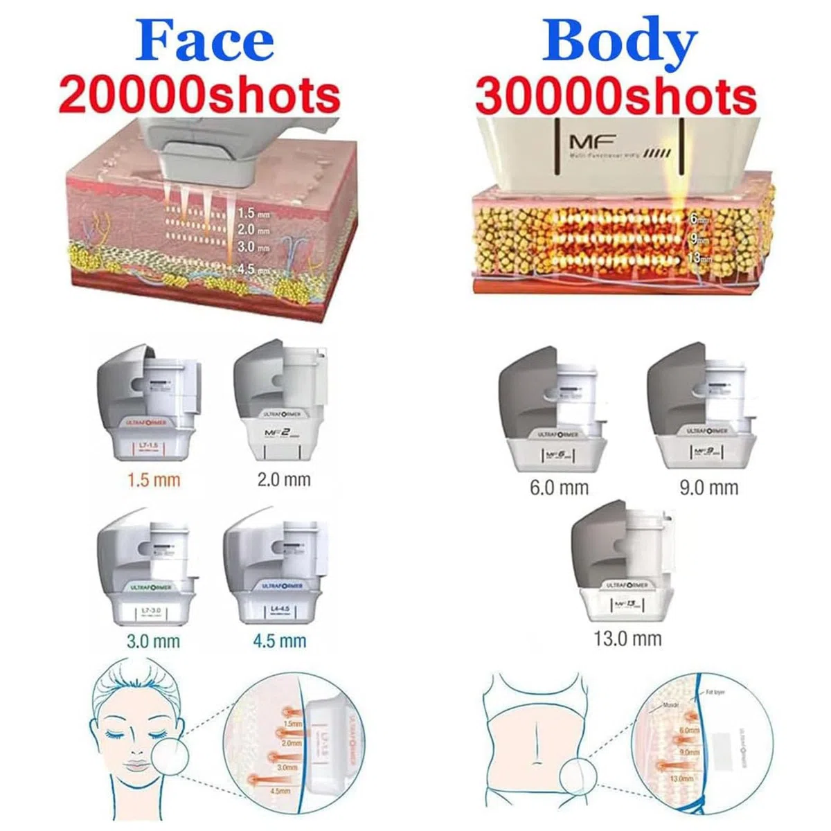 【Advanced 7D HIFU Skin Lifting & Body Contouring Machine】 2 Griffe, 7 Sonden zur Faltenreduzierung & Straffung