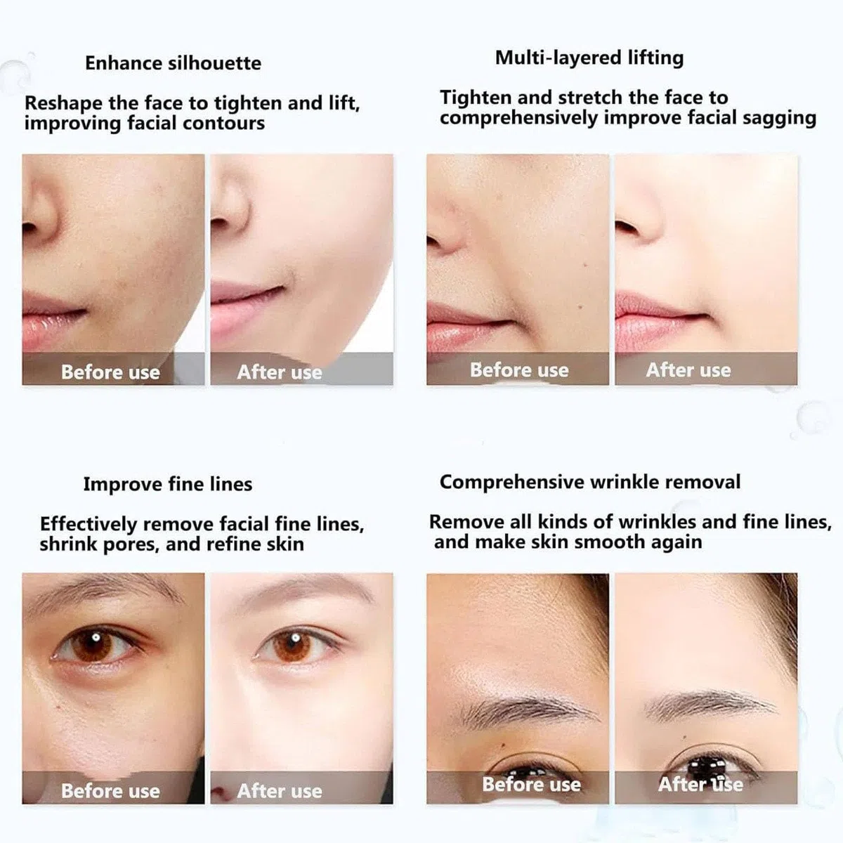 Facelifting Maschine, RF-Schönheitsinstrument Mit Doppelsonde (3,0 Mm/4,5 Mm), 7-Zoll-Touchscreen, Zur Faltenentfernung Und Zur Verwendung Im Anti-Aging-Schönheitssalon